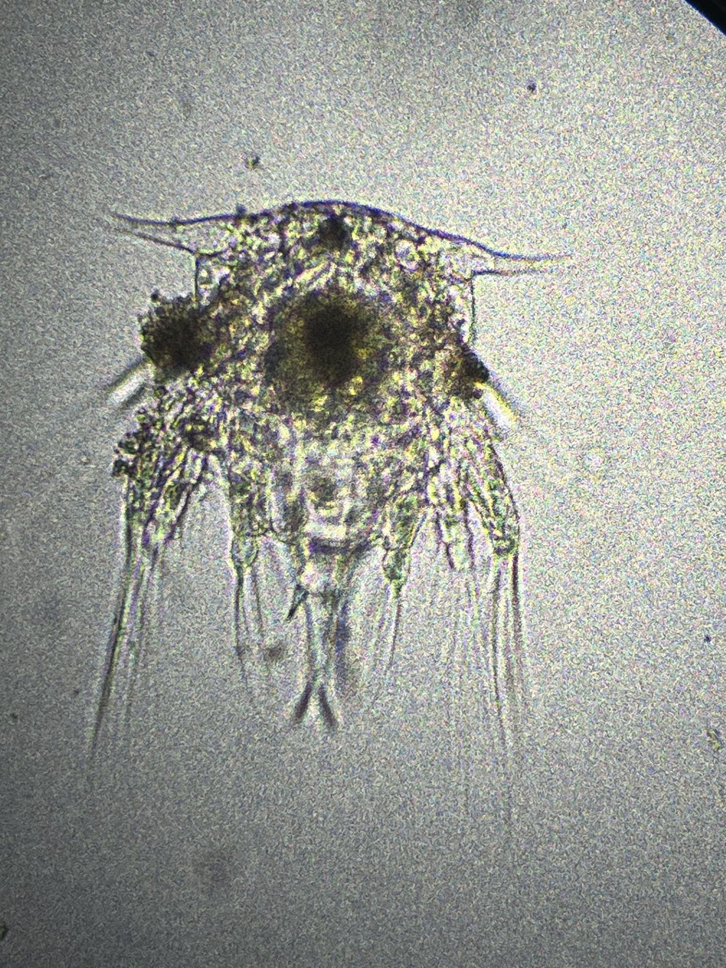 Nauplius-A Zooplankton A Zooplankton, Nauplius, underneath a microscope