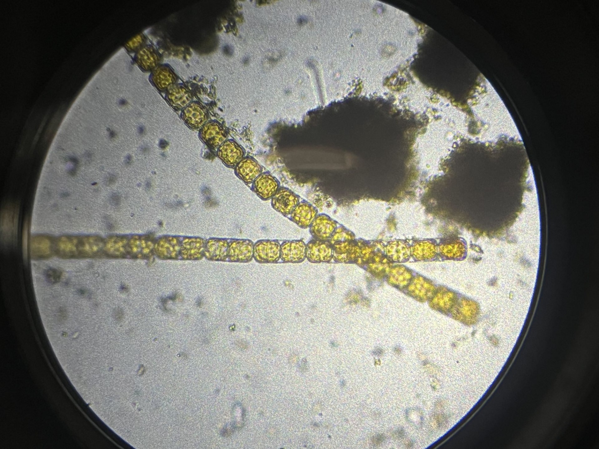 Melosira Species-A Phytoplankton Phytoplankton, Melosira, underneath a microscope