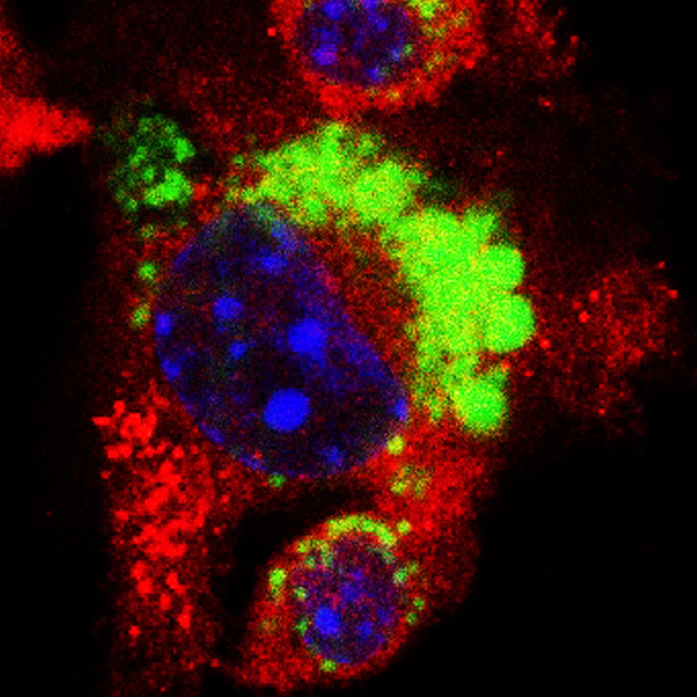 Human bone marrow immune cells absorbing nanoplastic