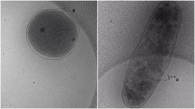 Cryo-electron microscopy images showing Prochlorococcus (left) and Alteromonas. The interaction between these two globally important microbes can be altered by ocean acidification. (Images: Terje Dokland, University of Alabama Birmingham).