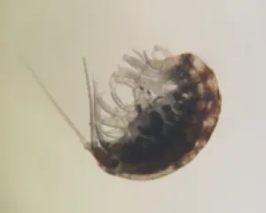 Zooplankton underneath the microscope