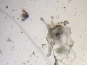 An unknown plankton and a nauplius under a microscope