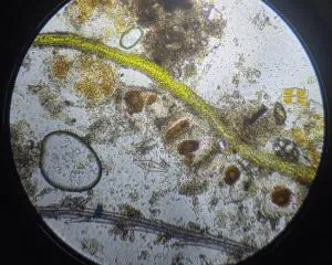 Plankton underneath a microscope 