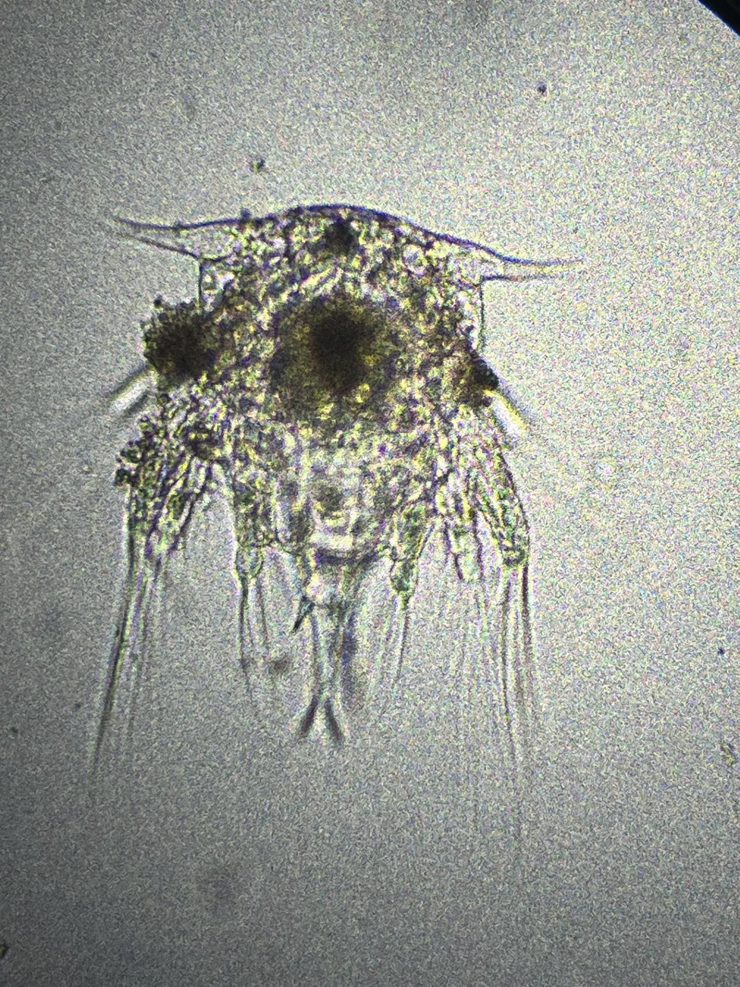 A Zooplankton, Nauplius, underneath a microscope