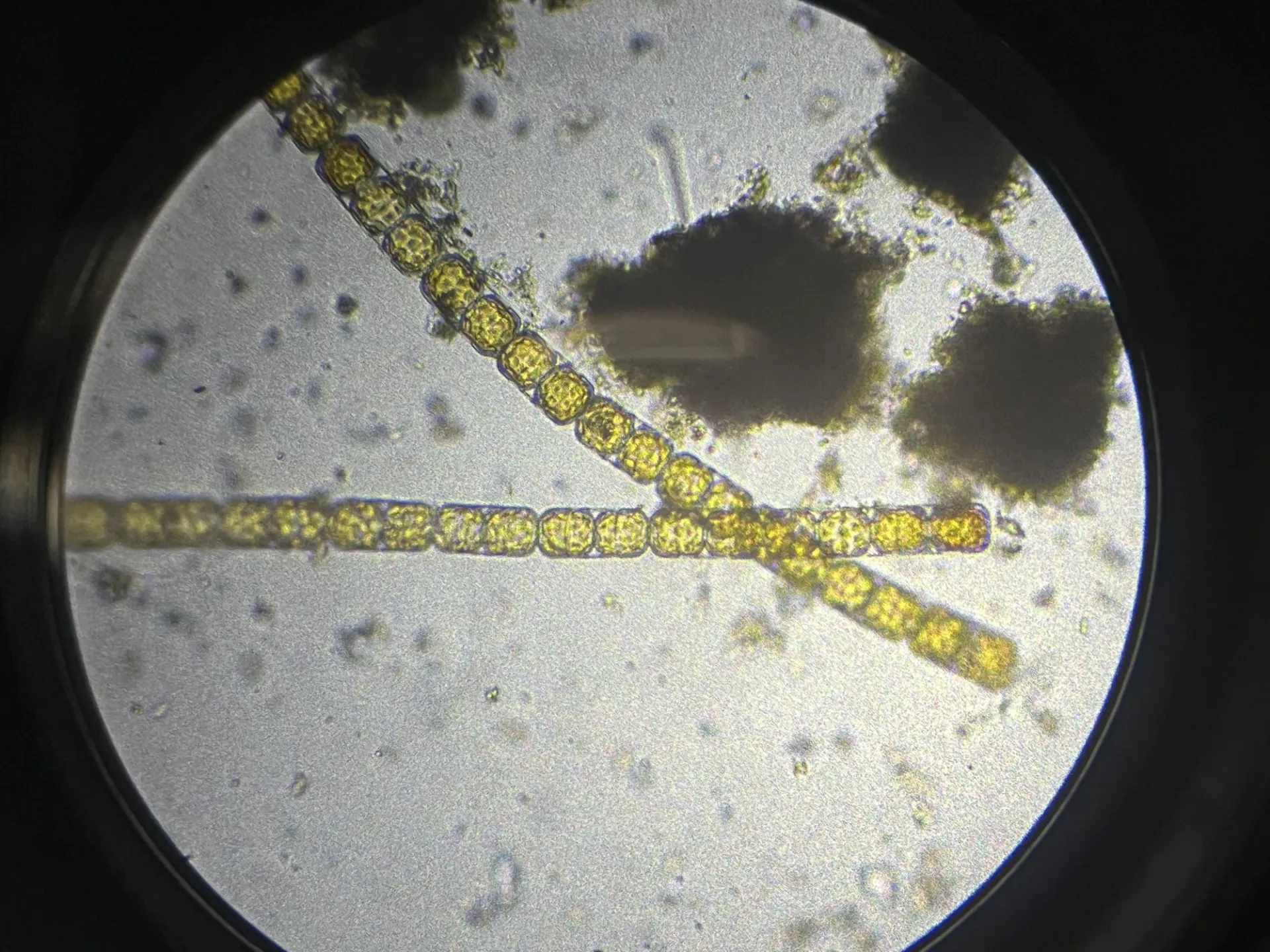 Phytoplankton, Melosira spp,, seen underneath a microscope