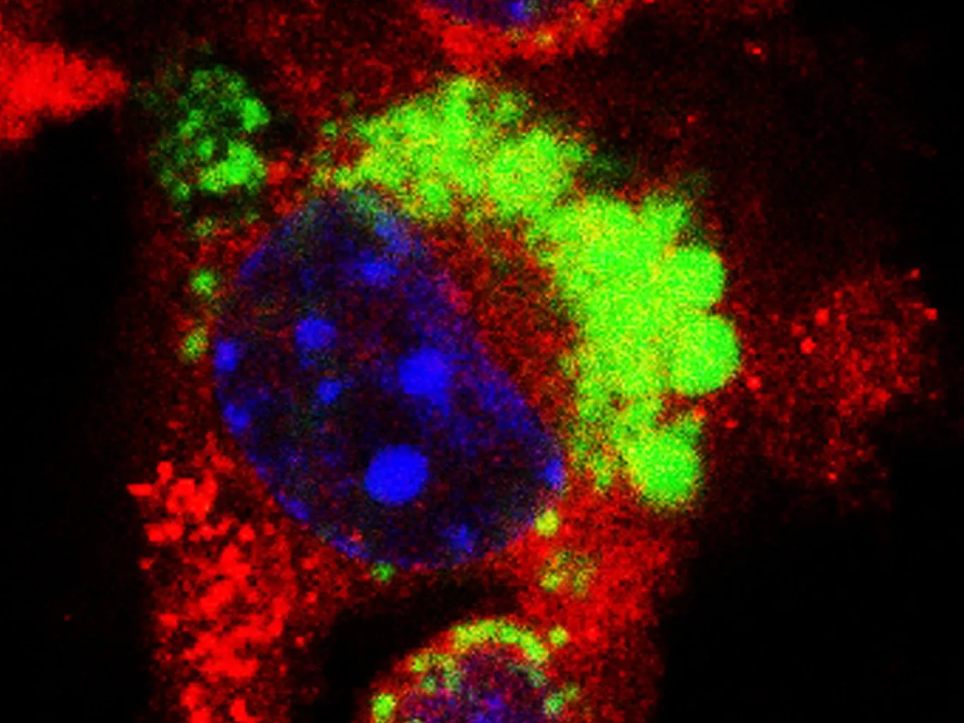 Macrophages, immune cells specialized to detect and clear body-foreign particles, absorbing nanoplastic particles. Credit: Marlene Schwarzfischer, University Hospital of Zurich, SNSC Scientific Image Competition