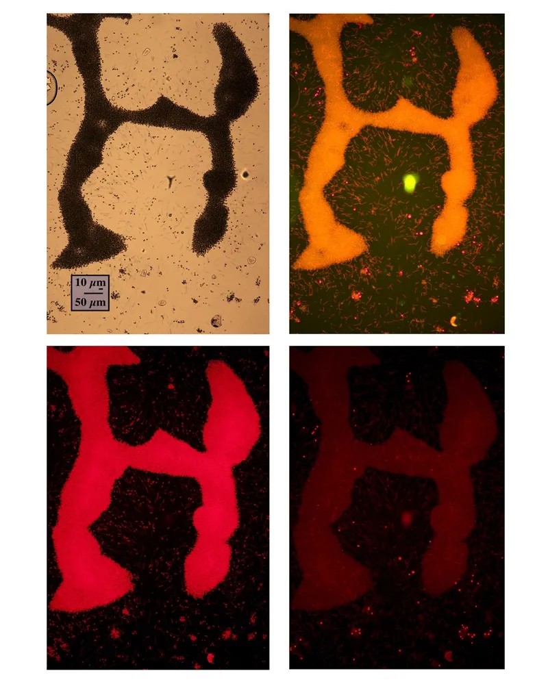Microcystis meets Marilyn By Andrew Juhl