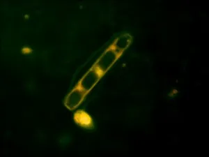 diatom