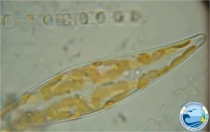 Phyto MDMR 303x190.png
