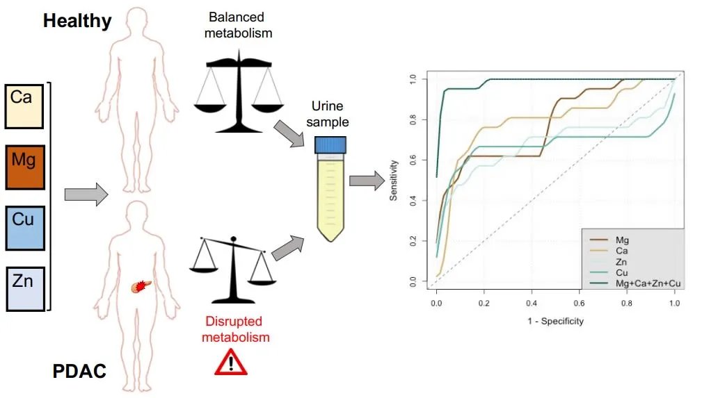 metal urine provides potential noninvasive test pancreatic cancer